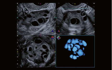 3 nouveaux échographes Aplio i700 chez Imalogie